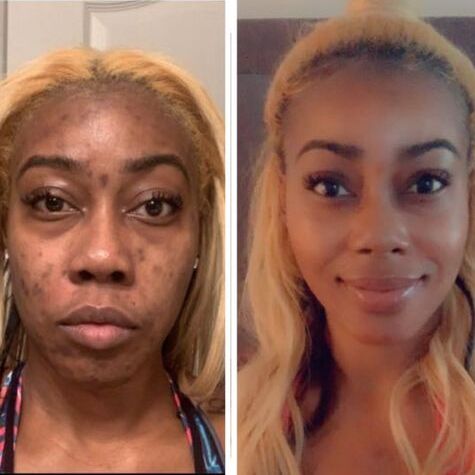 M-1™ Collagen-Boosting Brightening Moisturizer