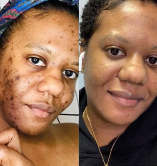 M-1™ Collagen-Boosting Brightening Moisturizer