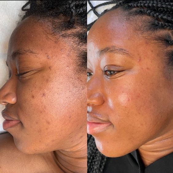 M-1™ Collagen-Boosting Brightening Moisturizer