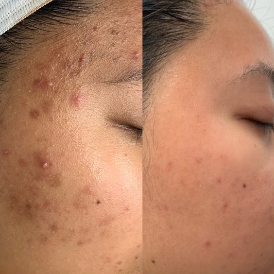 M-1™ Collagen-Boosting Brightening Moisturizer