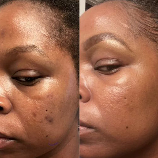 TC-1 - Turmeric & Vitamin C Clay Mask